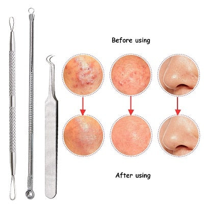 Black Dot Pimple Blackhead Remover Tool Needles For Squeezing Acne Tools Spoon for Face Cleaning Comedone Extractor Pore Cleaner